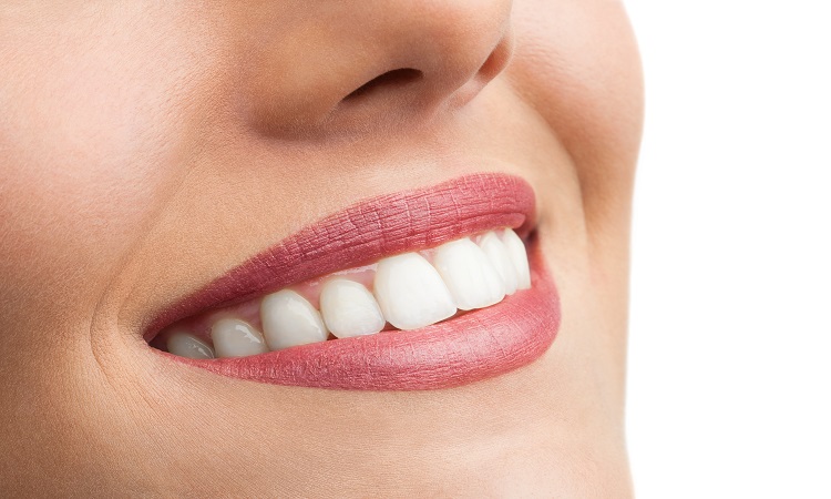 Dion Health Blog | What is a full smile makeover?